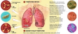 Всемирный день борьбы с туберкулезом